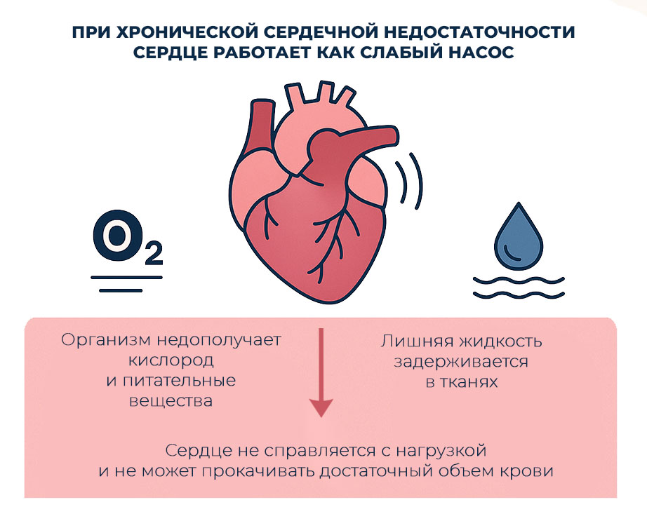 хроническая-сердечная-недостаточность-это-состояние-при-котором-сердце-не-справляется-с-нагрузкой-и-не-может-прокачивать-достаточный-объем-крови при-хронической-сердечной-недостаточности-сердце-продолжает-биться-но-с-меньшей-эффективностью