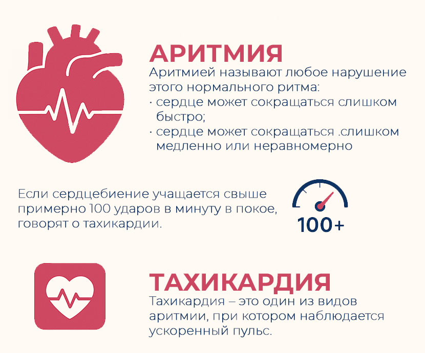 аритмией-называют-любое-нарушение-нормального-ритма определение-аритмия-тахикардия