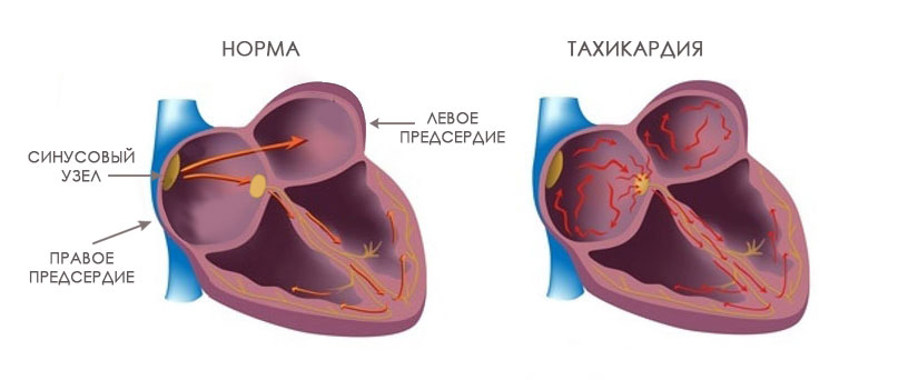 правильная-работа-сердца